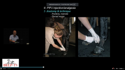 thumbnail for The Distal Hindlimb up to PSL 2025